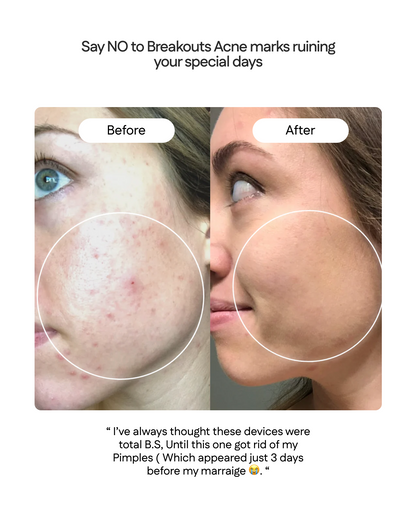 ELURA 3-IN-1 REVIVE WAND