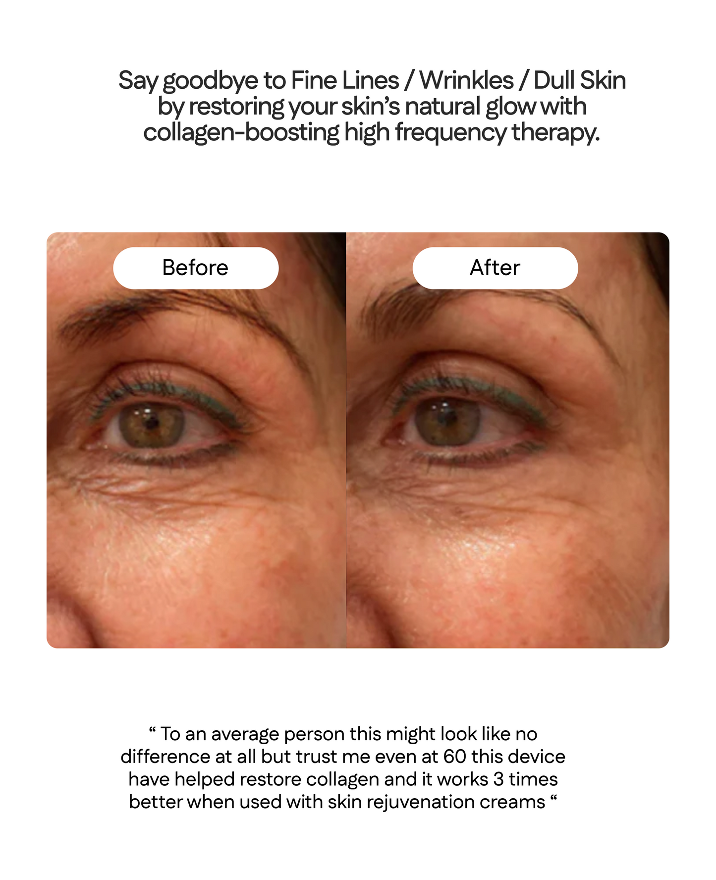 ELURA 3-IN-1 REVIVE WAND