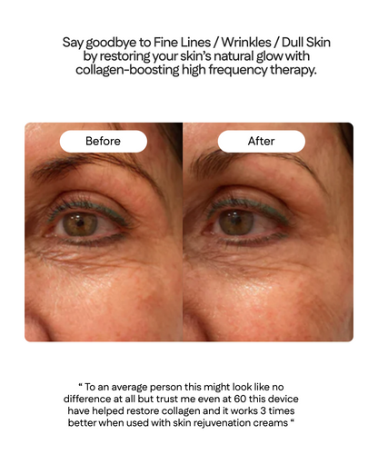 ELURA 3-IN-1 REVIVE WAND